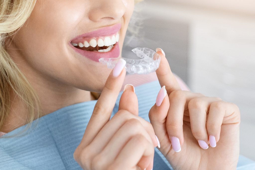 A close up shot of a women smiling while trying on Invisalign. Aura Dental is committed to helping your smile look and feel as good as it can.